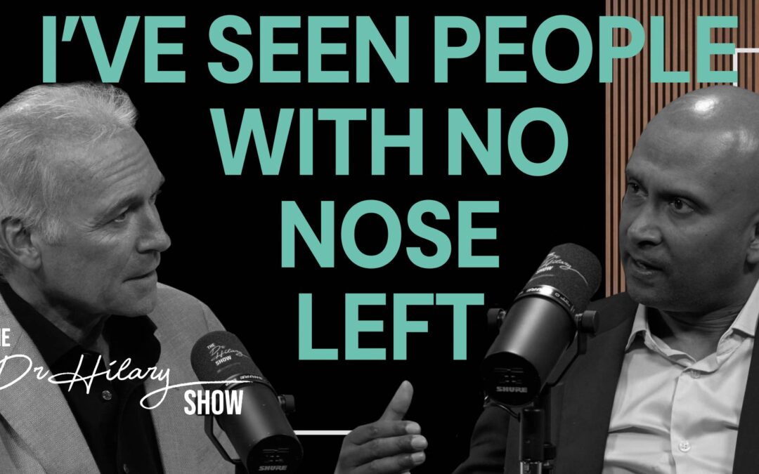 When cocaine destroys your nose: inside the surgery that can rebuild it